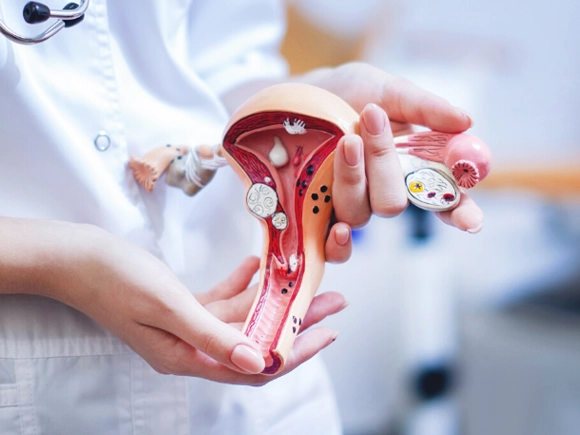 Pelvic Organ Prolapse (POP)