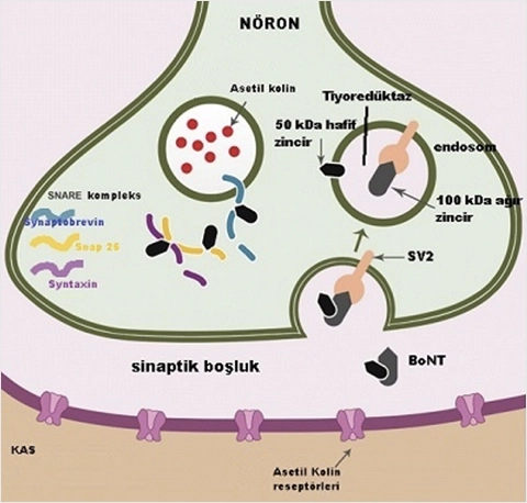 İdrar Kaçırma Tedavisinde Mesane Botoksu